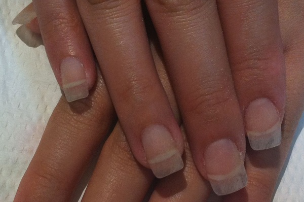 As seen in the picture (if you look under the acrylic extensions), the nail